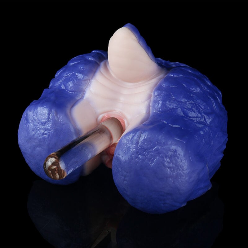 Close-up of a blue dental impression material surrounding a pink gum model with a metal dental instrument inserted into the area.