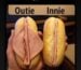 Innie vs. Outie Labia